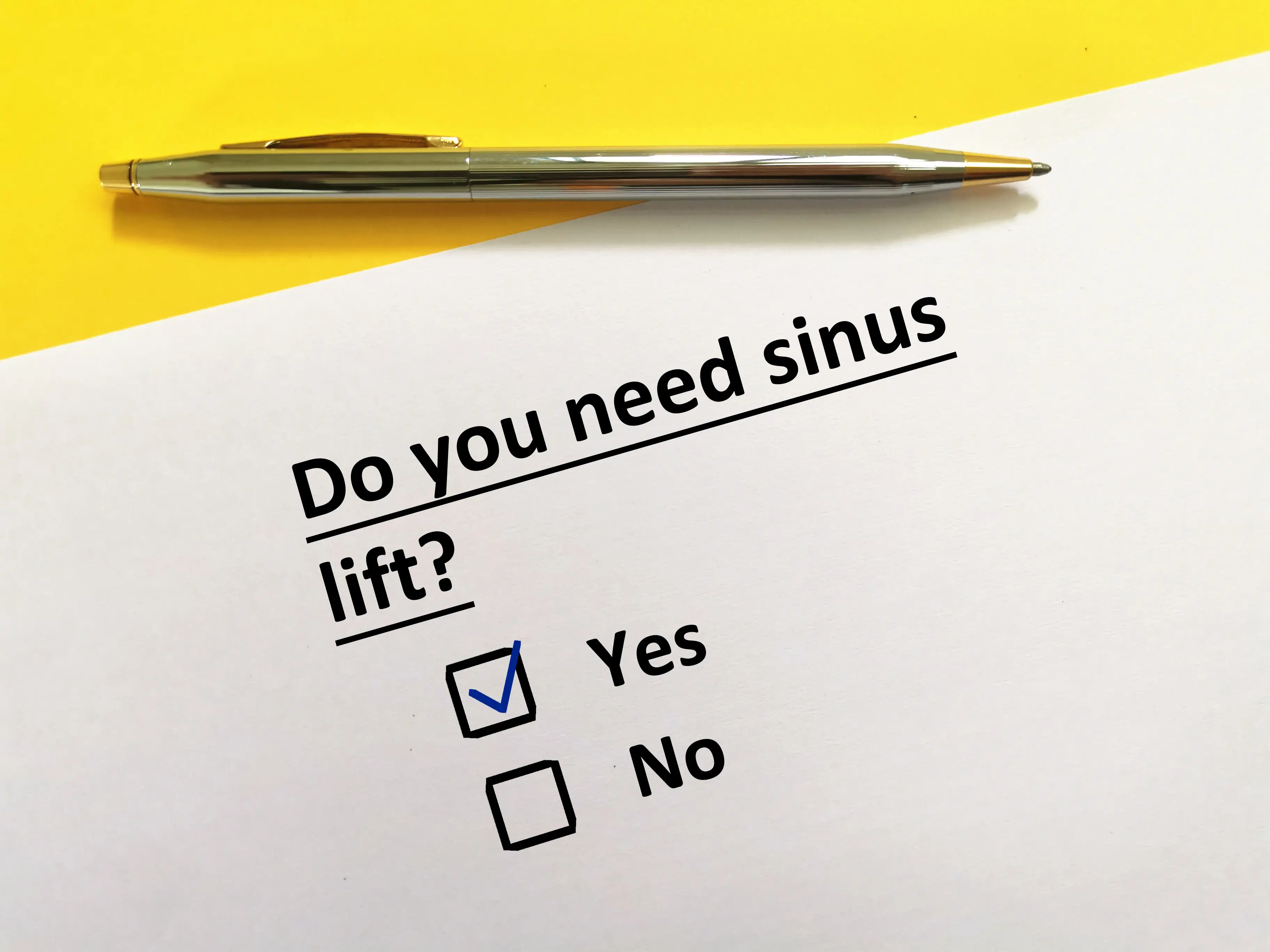 Understanding the Sinus Lift: A Key Step for Upper Dental Implants