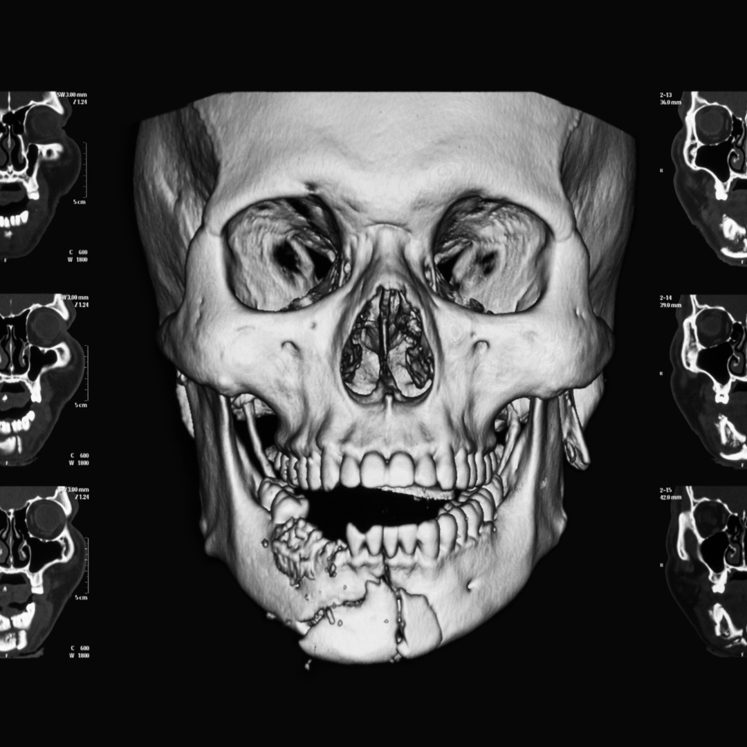 Image of facial trauma prior to oral surgery